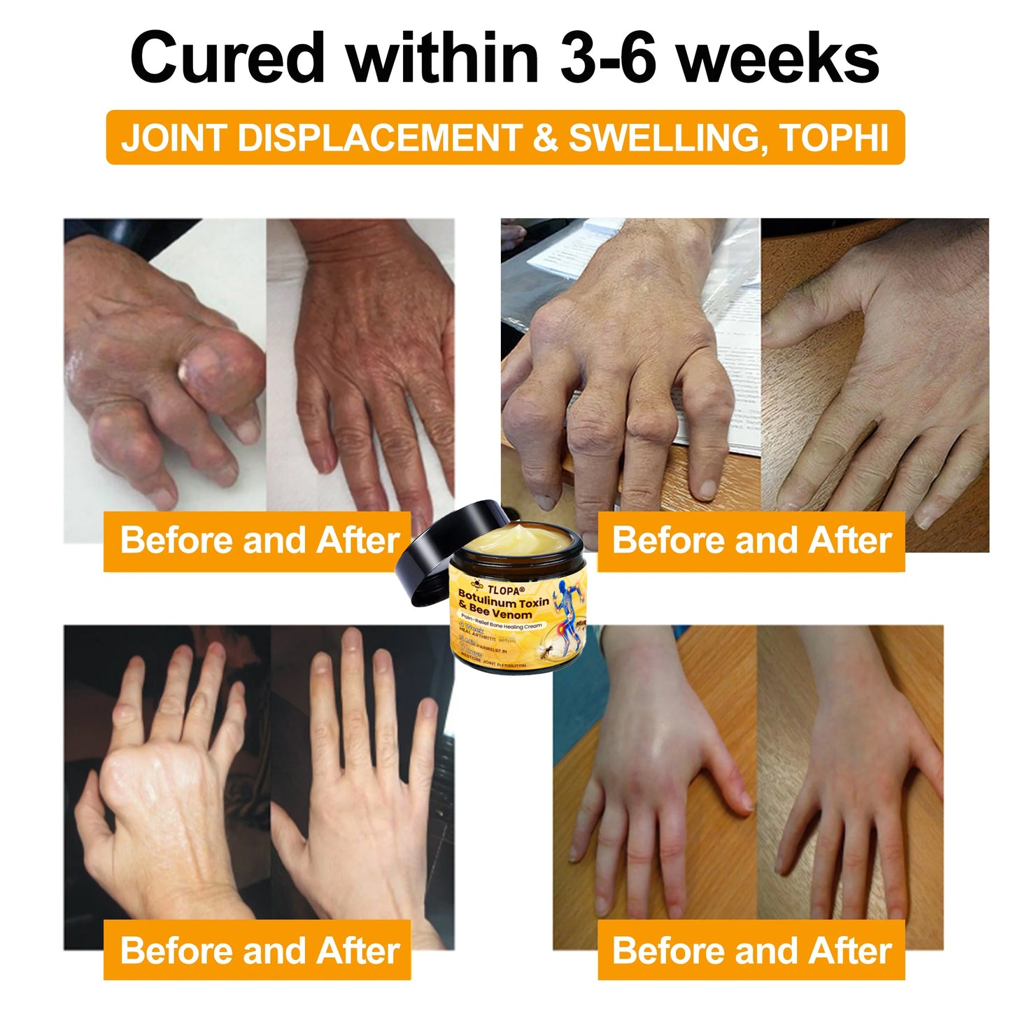 🔥FLASH SALE: Upgrade to VIP Advanced Customized Bones Healthy NOW – 50% Off ⏳ (Only 72 Hours Left!)