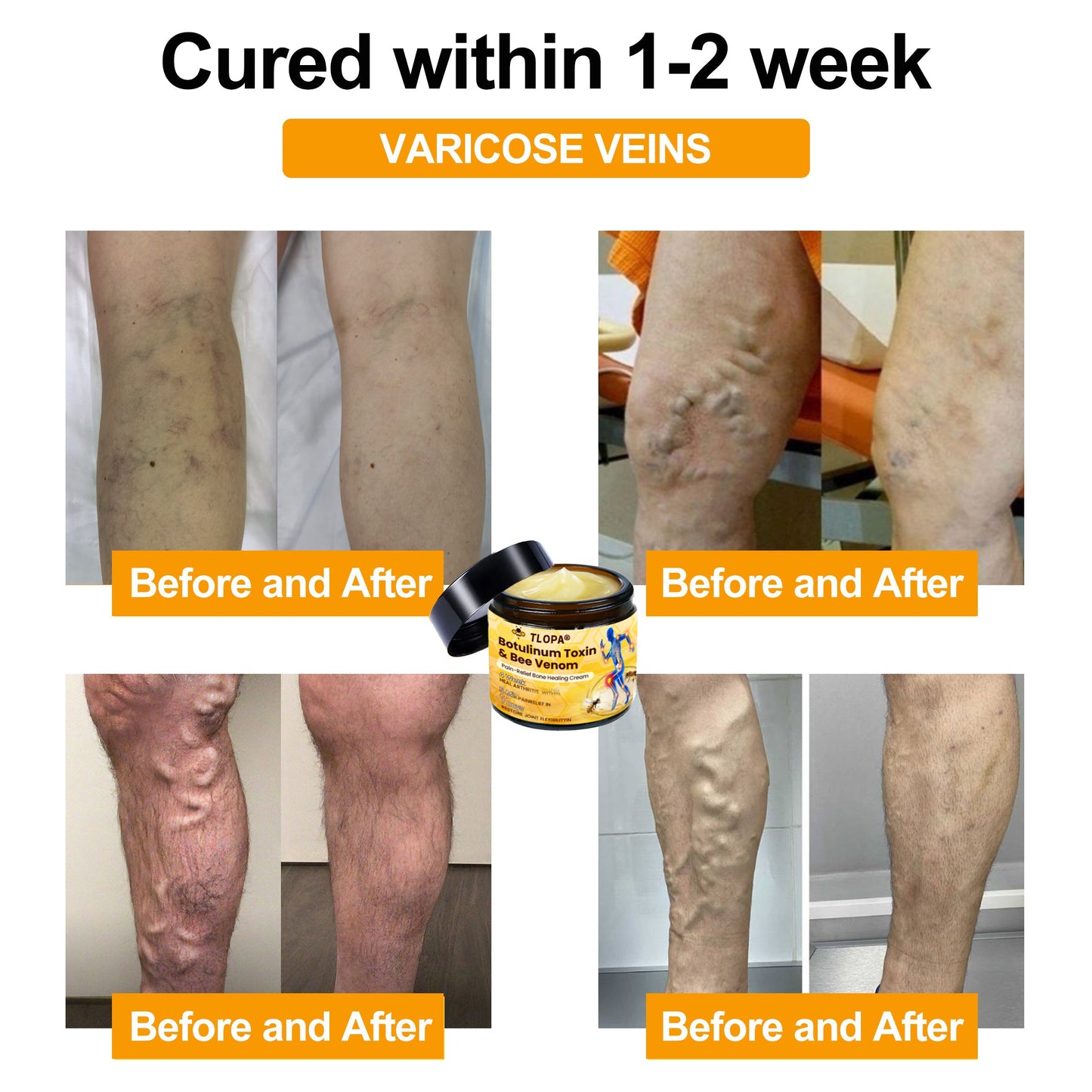 🔥FLASH SALE: Upgrade to VIP Advanced Customized Bones Healthy NOW – 50% Off ⏳ (Only 72 Hours Left!)