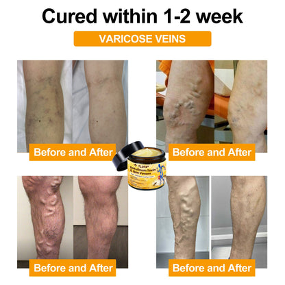 🔥FLASH SALE: Upgrade to VIP Advanced Customized Bones Healthy NOW – 50% Off ⏳ (Only 72 Hours Left!)